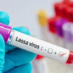 Health/ Togo strengthens preventive measures against Lassa fever outbreak in West Africa